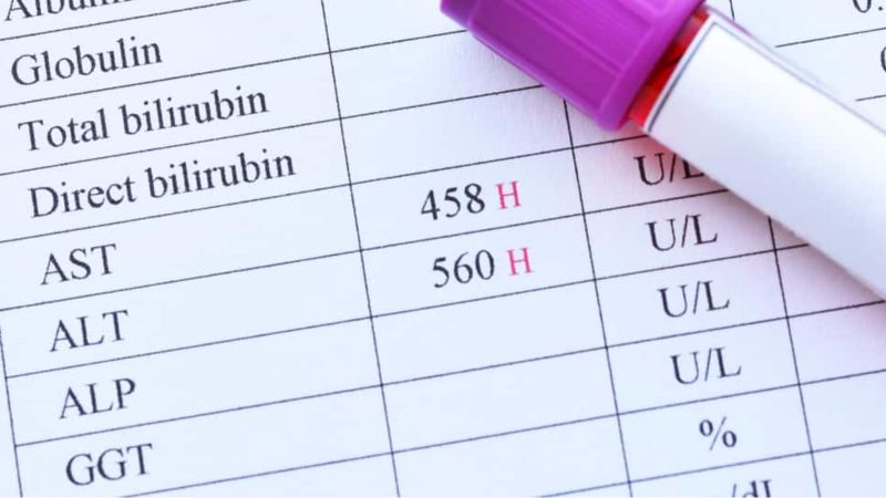 Các dấu hiệu và triệu chứng khi chỉ số men gan bất thường