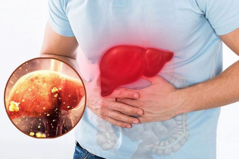 Triệu chứng nhận biết nóng gan