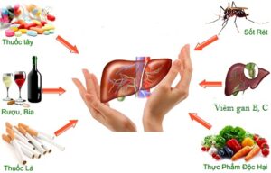 Cách phòng tránh bệnh về gan để bảo vệ sức khỏe tốt nhất