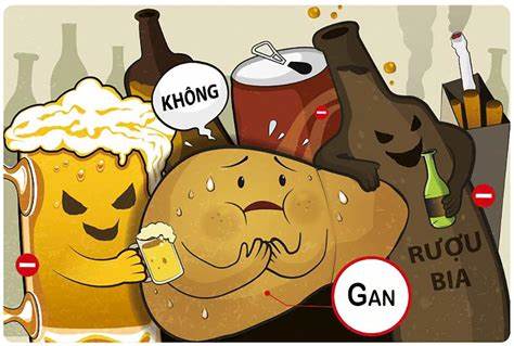 Rượu bia và nguy cơ gây gan nhiễm mỡ